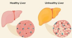 Healthy Liver for Weight Loss
