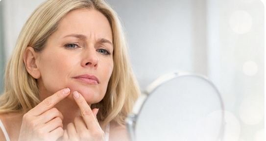 Menopausal Acne Skin Care