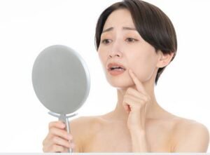 Menopausal Acne Skin Care