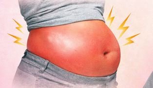 Menopausal Belly Bloat