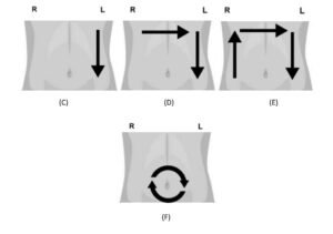 ilu massage for constipation