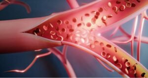 Cholesterol and Heart Health